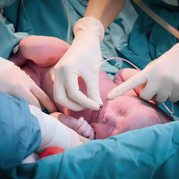 pediatra em-sala de parto neonatologista